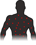 Rash / Red Spots Icon